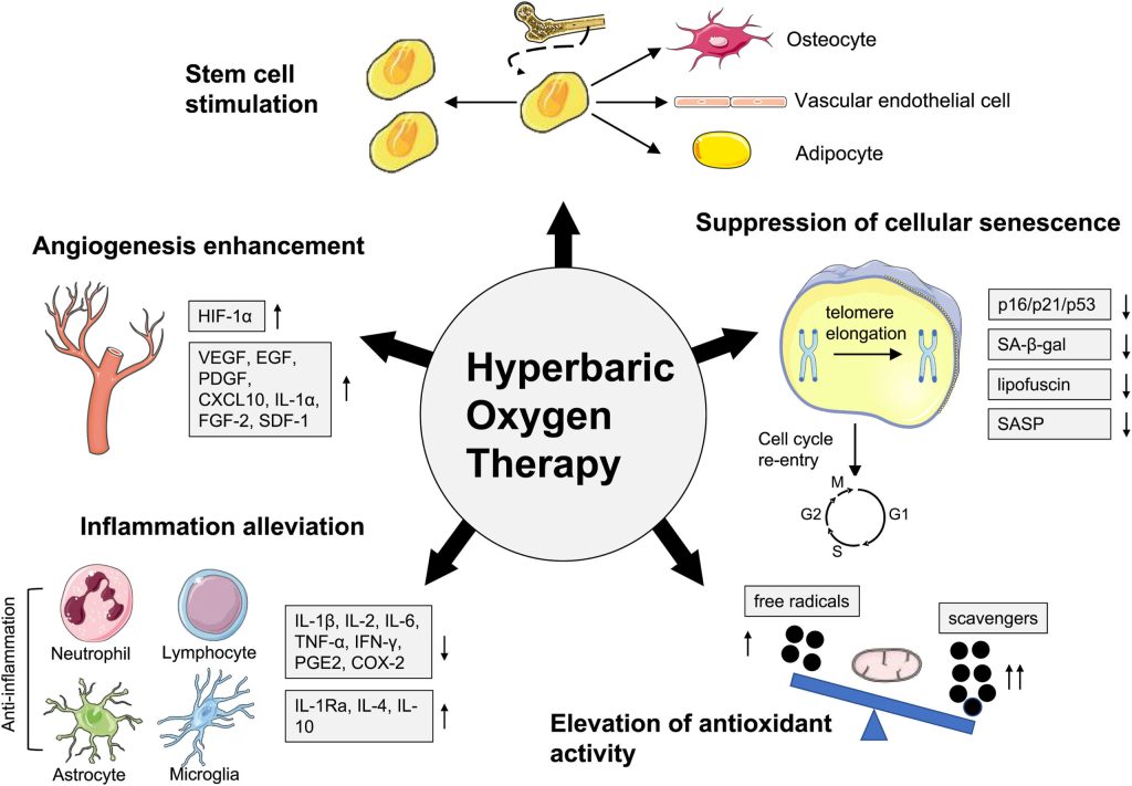 Hyperbaric Oxygen Therapy